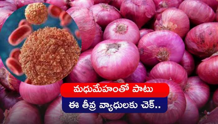 Onion For Diabetes: ప్రతి రోజూ ఉల్లిపాయలను తింటే మధుమేహంతో పాటు ఈ తీవ్ర వ్యాధులకు చెక్‌..