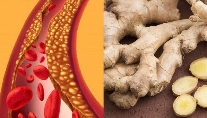 Ginger Benefits: ఆ ఒక్క మసాలా ఉంటే చాలు, ప్రమాదర కొలెస్ట్రాల్ సమస్యకు చెక్