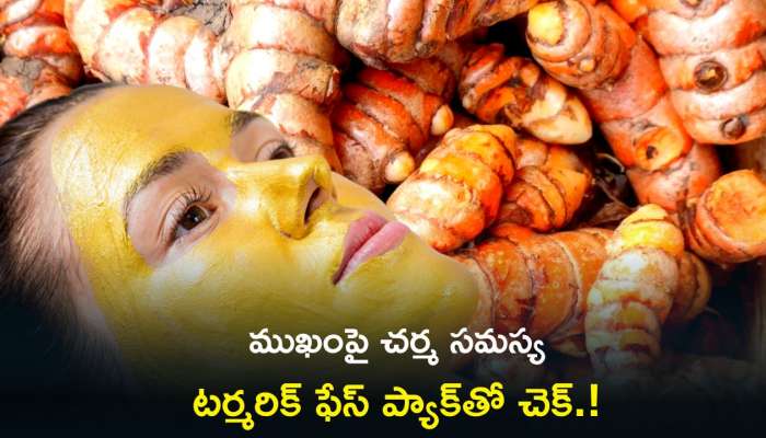 Turmeric For Face: ముఖంపై చర్మ సమస్యలేవైనా సరే జస్ట్‌ 2 రోజుల్లో చెక్‌.!