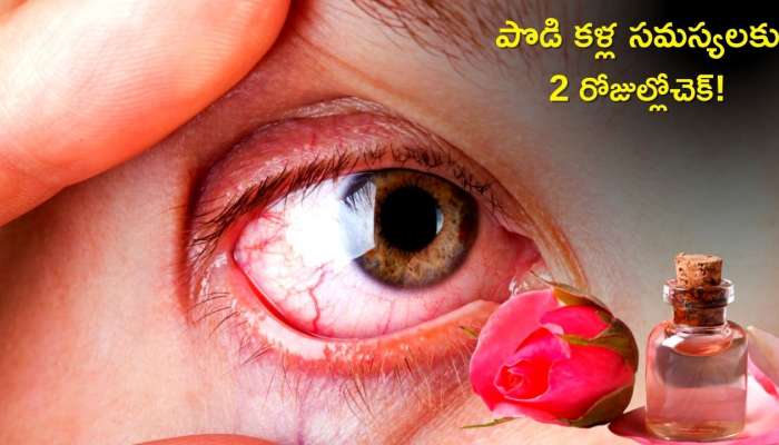 Dry Eyes Problem Solution: పొడి కళ్ల సమస్యలకు ఇలా 2 రోజుల్లో ఉపశమనం పొందవచ్చు!