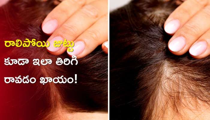 Reduce Hair Fall in 20 Days: ఈ ఫుడ్ తో రాలిపోయిన జుట్టు 20 రోజుల్లో తిరిగి రావడం ఖాయం!