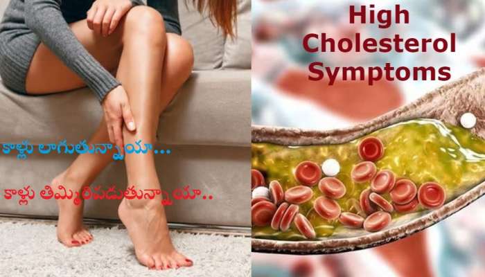 High Cholesterol Signs: ఈ లక్షణాలు మీలో గమనిస్తే ఇక అంతే సంగతి.. జాగ్రత్త సుమీ!