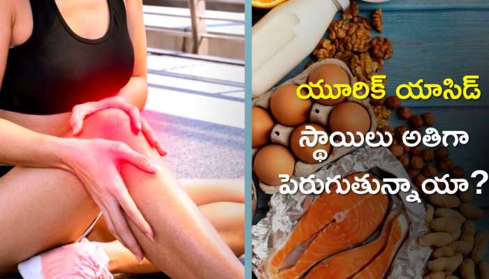 How To Control Uric Acid: యూరిక్ యాసిడ్ స్థాయిలు అతిగా పెరుగుతున్నాయా? కీళ్ల నొప్పులు ఇలా 9 రోజుల్లో మాయం!