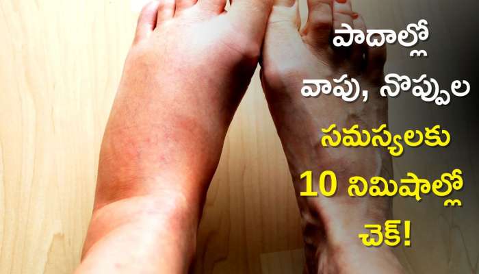  Swollen Feet: ఈ ఆయిల్‌తో పాదాల్లో వాపు, నొప్పుల సమస్యలకు 10 నిమిషాల్లో చెక్‌!