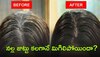 White Hair To Black Hair: నల్ల జుట్టు కలగానే మిగిలిపోయిందా?, తెల్ల జుట్టు ఉన్న వారు ఇలా చేస్తే నల్ల జుట్టు 20 రోజుల్లో రావడం ఖాయం!