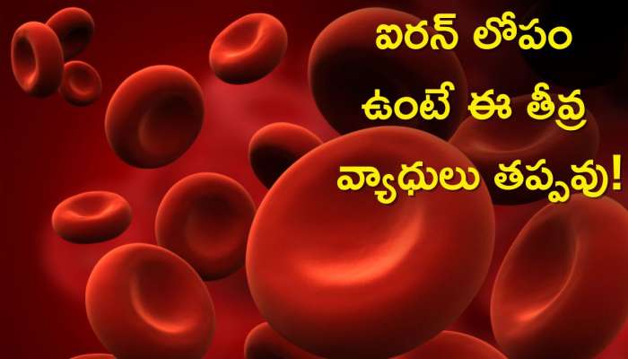 Iron Deficiency Disease: ఐరన్‌ లోపం ఉంటే ఈ తీవ్ర వ్యాధులు తప్పవు!, మీలో ఈ లోపం ఉందా?