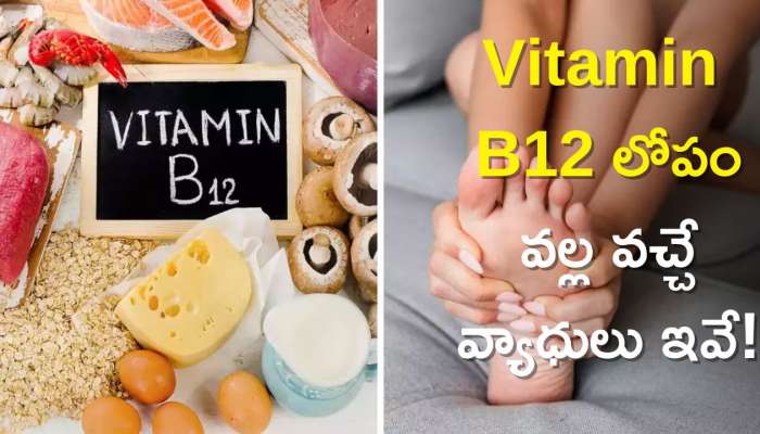 Vitamin B12: Vitamin B12 లోపం వల్ల వచ్చే వ్యాధులు ఇవే, వీటి బారిన పడితే అంతే సంగతి!