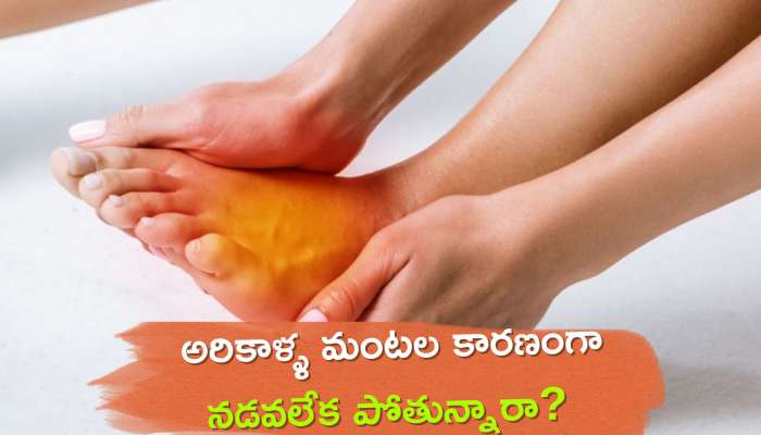 Burning Feet: అరికాళ్ళ మంటల కారణంగా నడవలేక పోతున్నారా? ఇలా సులభంగా 5 రోజుల్లో చెక్ పెట్టొచ్చు..