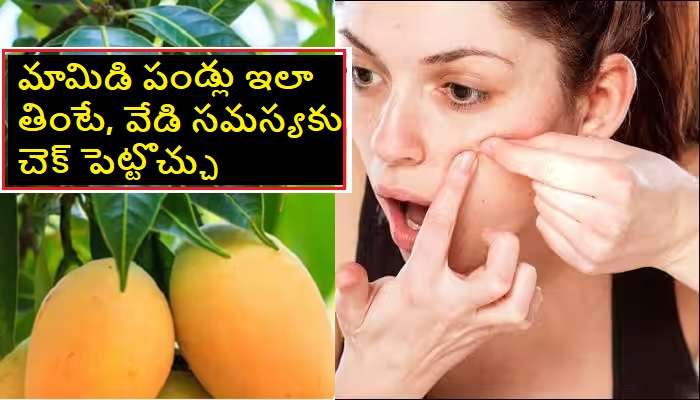 Pimples on Face after eating mangoes: మామిడి పండ్లు తిన్న తరువాత వేడి కురుపులు, మొటిమలు రాకుండా ఉండాలంటే..
