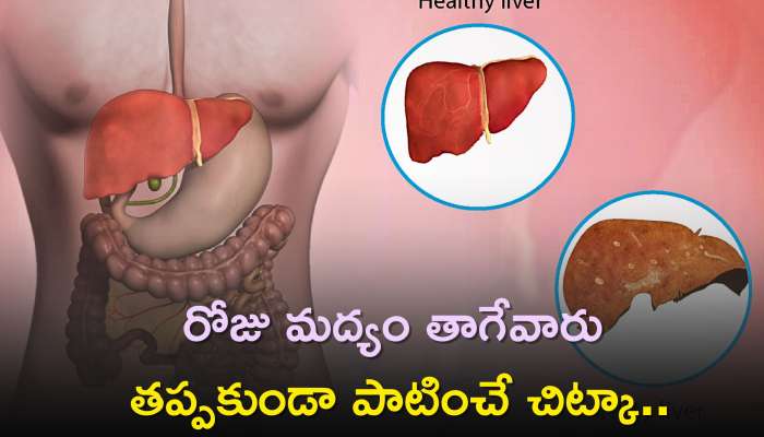Fatty Liver Disease: ఫ్యాటీ లివర్ సమస్యలతో బాధపడుతున్నారా, రోజు మద్యం తాగేవారు తప్పకుండా పాటించే చిట్కా