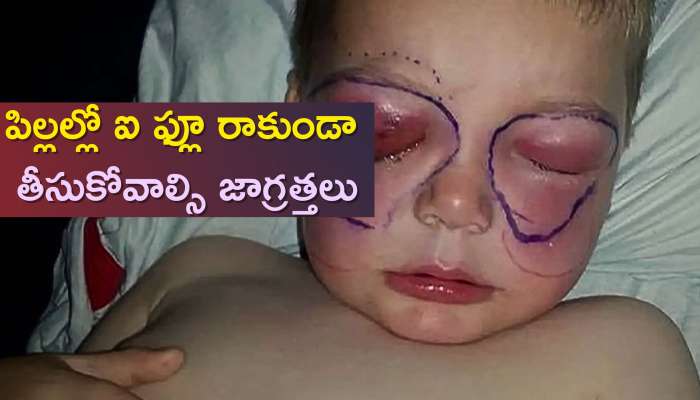 Kid Eye Infection Treatment: పిల్లల్లో ఐ ఫ్లూ రాకుండా తీసుకోవాల్సి జాగ్రత్తలు, పాటించాల్సిన నియమాలు..