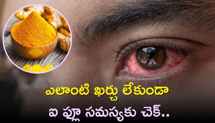 Eye Flu Home Remedies: ఎలాంటి ఖర్చు లేకుండా ఐ ఫ్లూ సమస్యకు చెక్.. ఈ మిశ్రమాన్ని రాస్తే చాలు..