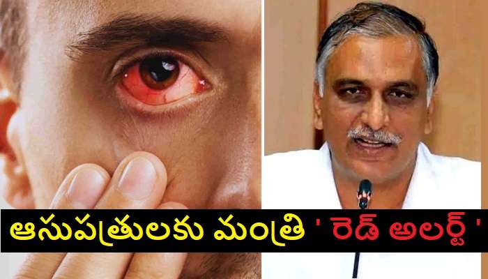 Harish Rao about Eyes Flu: కళ్ల కలక కేసులు పెరుగుతున్నాయి జాగ్రత్త 