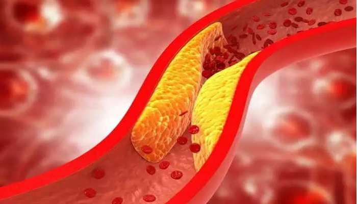 Cholesterol Tips: కొలెస్ట్రాల్ సమస్యకు సూపర్ చిట్కా, వేడి నీళ్లతో పరిష్కారం