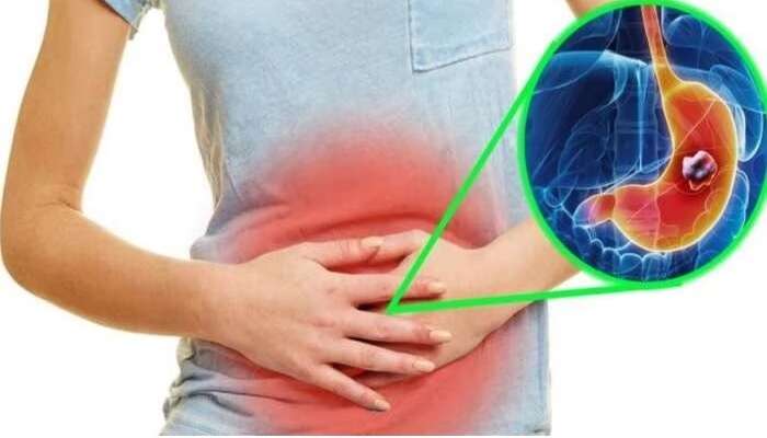 Digestive System: మీ జీర్ణ వ్యవస్థ బలహీనంగా ఉందా, అయితే ఈ 5 వ్యాధులు రావచ్చు జాగ్రత్త