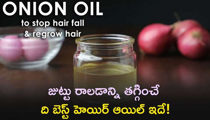 Hair Fall Control Oil: జుట్టు రాలడాన్ని తగ్గించే ది బెస్ట్‌ హెయిర్‌ ఆయిల్‌ ఇదే!