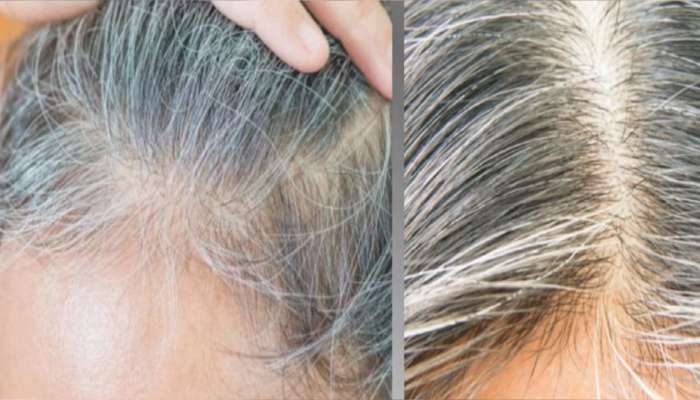 Turn White Hair to Black: తెల్ల జుట్టును నల్లగా మార్చే బెల్లం, మెంతి విత్తనాలు.. ట్రై చేయండి మీకే తెలుస్తుంది!