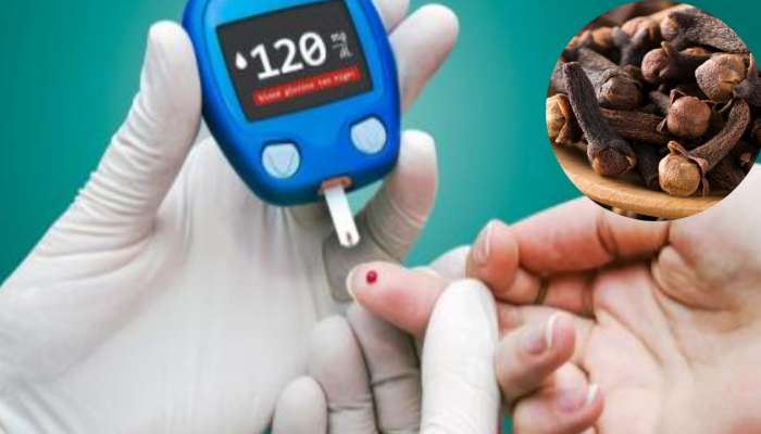 Diabetes Prevention Tips: లవంగాలతో డయాబెటిస్‌కు చెక్.. నమ్మట్లేదా..? అయితే ఇది చదవండి!