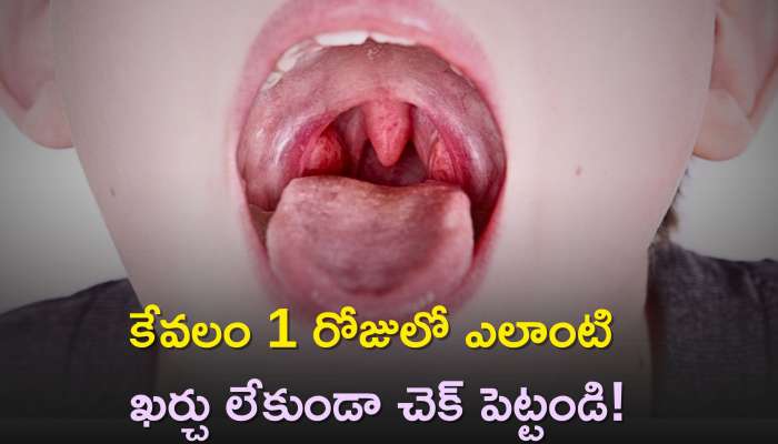 Home Remedies For Tonsils: టాన్సిల్స్‌తో బాధపడుతున్నారా? కేవలం 1 రోజులో ఎలాంటి ఖర్చు లేకుండా చెక్‌ పెట్టండి!