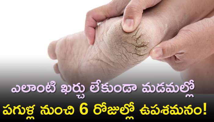 Home Remedies For Cracked Heels: ఎలాంటి ఖర్చు లేకుండా మడమల్లో పగుళ్ల నుంచి 6 రోజుల్లో ఉపశమనం!