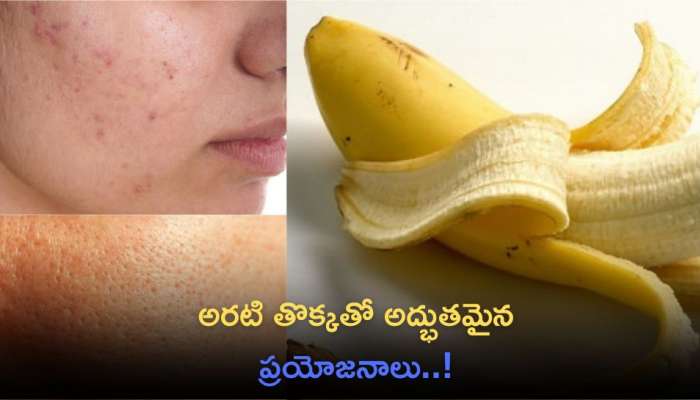 Banana Peel Benefits For Skin: అరటి తొక్కతో అద్భుతమైన ప్రయోజనాలు..!