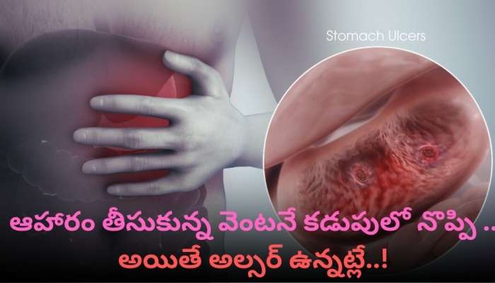 Ulcer: ఆహారం తీసుకున్న వెంట‌నే క‌డుపులో నొప్పి .. అయితే అల్స‌ర్ ఉన్న‌ట్లే..!