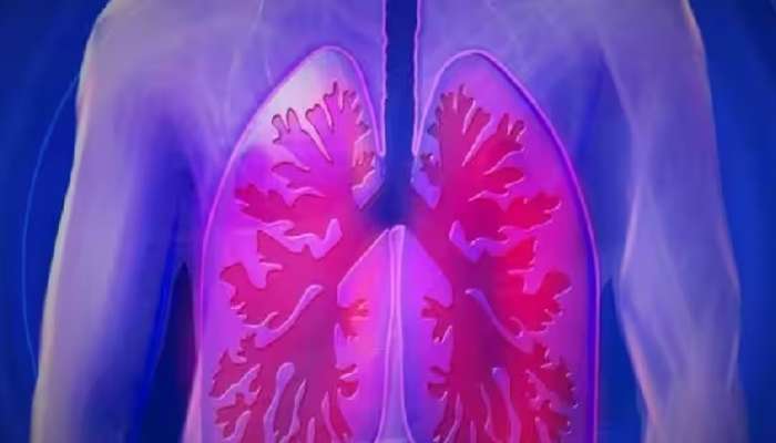 Lungs Health Signs: ఊపిరితిత్తుల్లో సమస్య ఉంటే ఎలా తెలుస్తుంది, ఏ లక్షణాలు కన్పిస్తాయి