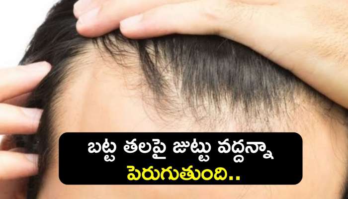 Hair Growth Tips Telugu: ఈ ఆహారాలను ప్రతిరోజూ తీసుకుంటే..బట్ట తలపై జుట్టు వద్దన్నా పెరుగుతుంది..
