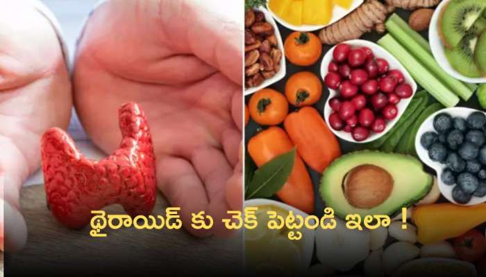 Foods For Thyroid: థైరాయిడ్‌ బారిన పడకుండా ఉండాలా.. రోజూ వీటిని తీసుకోండి చాలు!