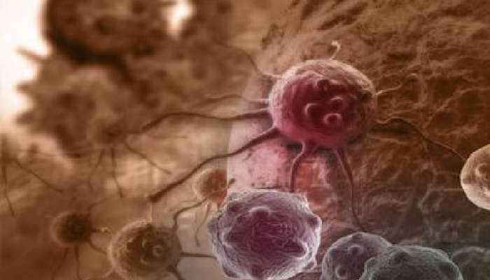 Sarcoma Cancer: సర్కోమా కేన్సర్ అంటే ఏమిటి, ఎందుకిది అత్యంత ప్రమాదకరం, లక్షణాలేంటి