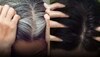 White Hair: తెల్లజుట్టు సమస్య.. ముఖ్య కారణాలు ఇవే!