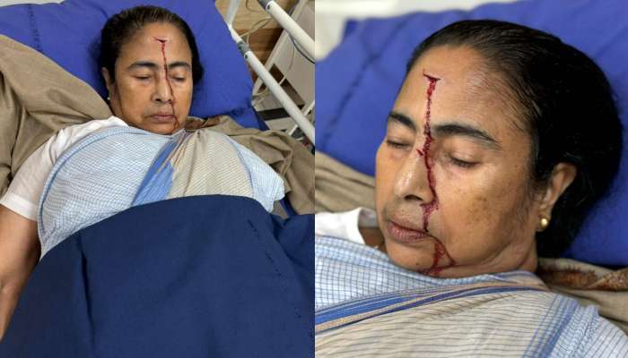 Mamata Injury: పశ్చిమ బెంగాల్‌లో కలకలం.. సీఎం మమతా బెనర్జీకి తీవ్ర గాయం.. అసలేం జరిగింది?