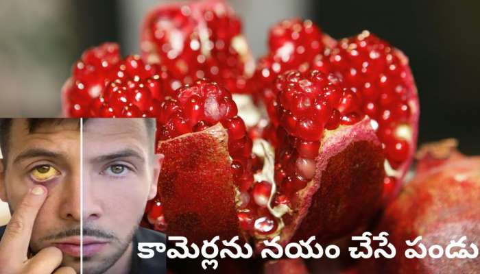 Fruit Cures Jaundice: కామెర్లను నయం చేసే శక్తి ఈ ఎర్రటి పండుకు ఉంది.. అదేంటో తెలుసా?