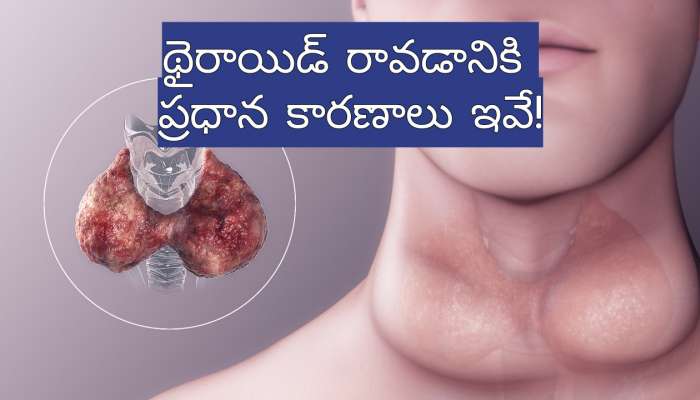  Hypothyroidism: చిన్న వయసులోనే థైరాయిడ్ రావడానికి ప్రధాన కారణాలు ఇవే!