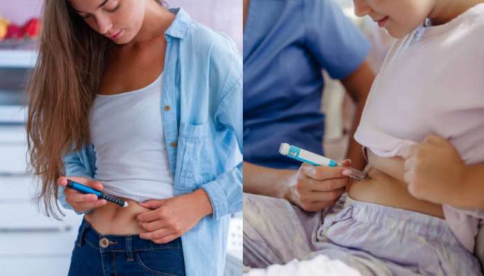 Diabetes Diet Tips: మీకు డయాబెటిస్ ఉందా..?.. సమ్మర్ లో ఖచ్చితంగా తినాల్సిన ఫుడ్ ఐటమ్స్ ఇవే..