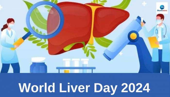 World Liver Day 2024: ఫ్యాటీ లివర్ ప్రాణాంతకంగా మారిందని సూచించే లక్షణాలు ఇవే..