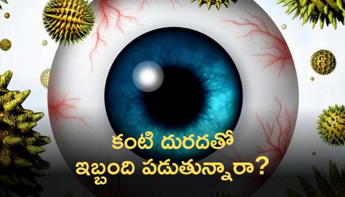 Remedies For Itchy Eyes: కంటి దురదతో ఇబ్బంది పడుతున్నారా?  ఈ ఇంటి చిట్కాలు మీకోసం!