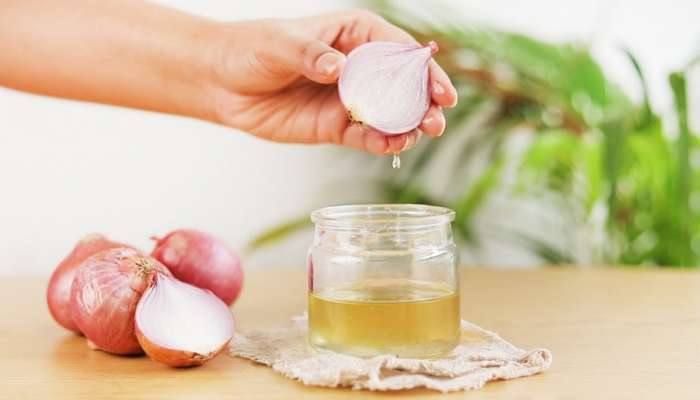 Onion Oil For Hair Benefits: ఉల్లిపాయ నూనెతో జుట్టుకు జీవకళ.. తయారీ విధానం తెలుసా?