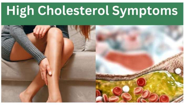 High Cholesterol Symptoms: మీ శరీరంలో కొలెస్ట్రాల్ స్థాయిలు ప్రాణంతకంగా మారిందని సూచించే 10 లక్షణాలు..