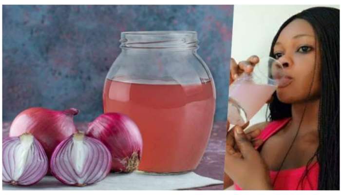Benefits Of Onion Water For Hair: ఉల్లిపాయ రసం ఇలా వాడితే జుట్టు వద్దన్నా పెరుగుతూనే ఉంటుంది..