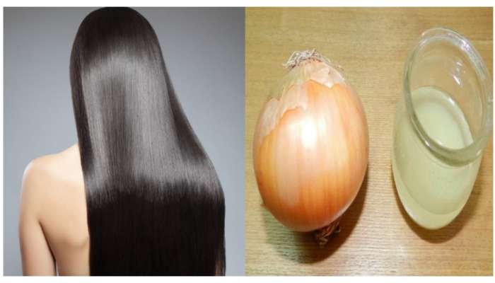 Onion For Quick Hair Growth: జుట్టుకు ఇలా ఉల్లిపాయరసం వాడారంటే.. ఆగకుండా పెరుగుతుంది.. ఊడమన్నా ఊడదు..
