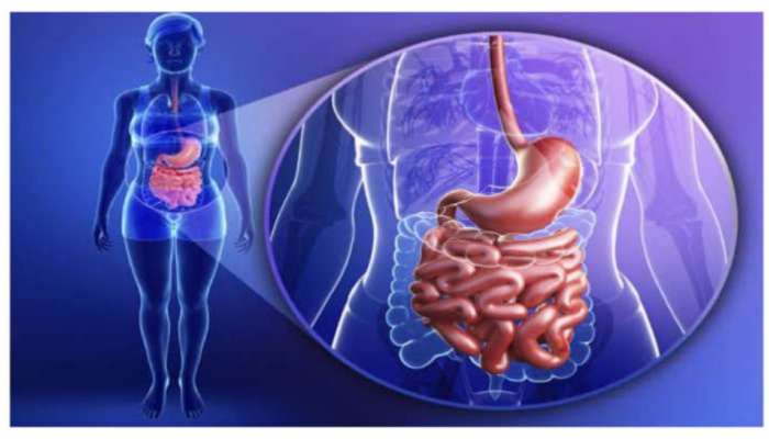 Gut Health: కడుపు ఆరోగ్యాన్ని పాడు చేసే 8 ఆహారాలు.. కచ్చితంగా వీటికి దూరంగా ఉండాల్సిందే..