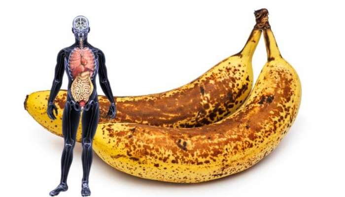 Bananas Benefits: నల్ల మచ్చలు ఉన్న అరటిపండ్లు ఎందుకు మంచివి?