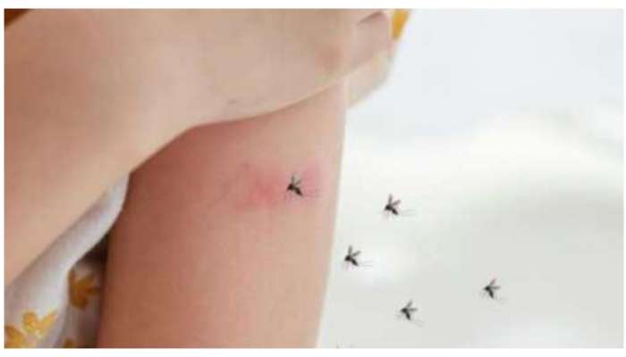 Get Rid Of Mosquitoes: పెరుగుతున్న దోమలు.. మీ పిల్లల్ని 6 విధాలుగా  రక్షించుకోండి..