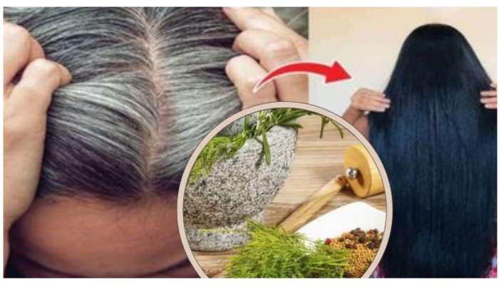 Grey Hair: ఈ 10 మూలికలతో కూడా తెల్ల జుట్టుకు చెక్ పెట్టవచ్చు.. వాడే విధానం ఇదే..