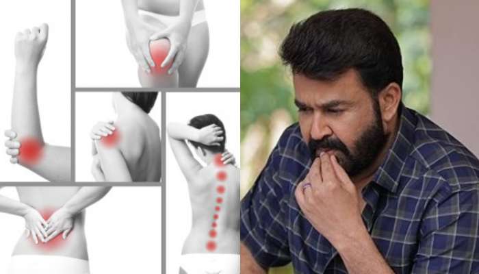 Mohanlal: మోహన్‌లాల్‌కు సోకిన మైయాల్జియా ప్రాణాంతకమా? దీని లక్షణాలు ఏమిటి?