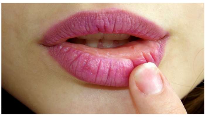 Lip Care: నెయ్యి ఇలా పెదాలకు అప్లై చేస్తే నేచురల్‌గా పింక్ రంగులోకి మారిపోతాయి..