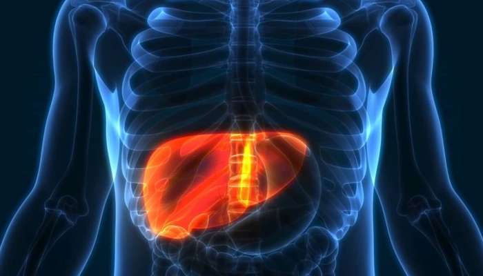 Liver Health: నాన్ ఆల్కహాల్‌ వారికి లీవర్‌ ఎందుకు దెబ్బతింటుంది? కారణాలు ఇవే