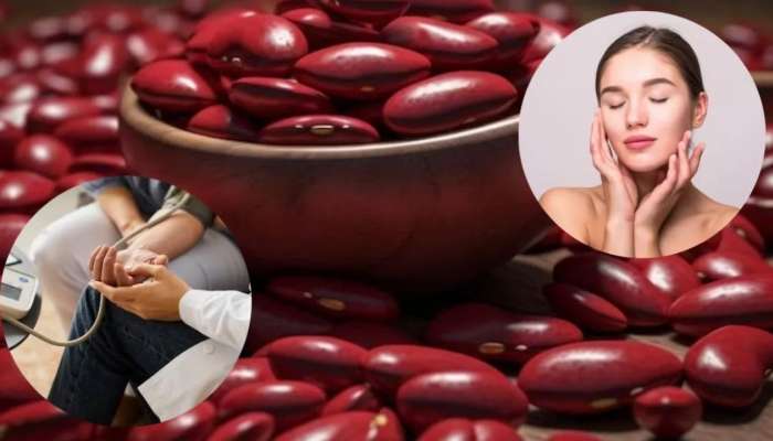 Rajma Seeds: ప్రతిరోజు రాజ్మాను తీసుకుంటే ఈ సమస్యలకు చెక్..!