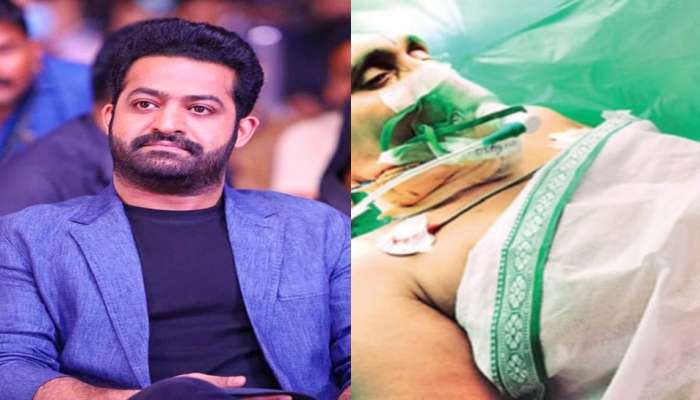 Jr NTR: ఎన్టీఆర్ మూవీ చూపిస్తూ అభిమానికి బ్రెయిన్ సర్జరీ.. దీనికి సహాయపడిన అవేక్ క్రానియోటమీ అంటే ఏంటి? 